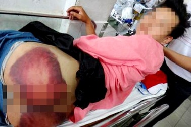 Điều tra vụ một thanh niên bị công an đánh