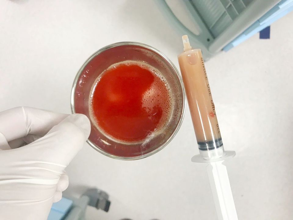 Cậu học trò nguy kịch chỉ vì vết trầy ở khớp gối - 2 Cậu học trò nguy kịch chỉ vì vết trầy ở khớp gối - 2