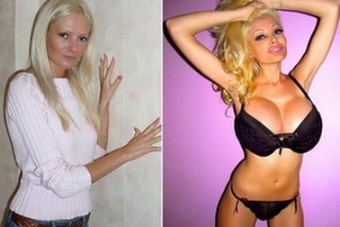 Cô gái chi hơn 30.000 bảng Anh để biến thành “búp bê người lớn”