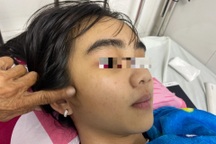 Thiếu nữ Hậu Giang kể phút bị người đàn ông cao lớn đấm liên tiếp vào mặt