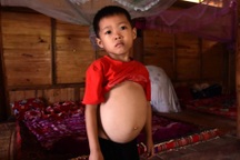 Mong manh sự sống của cậu bé 6 tuổi mắc bệnh hiểm nghèo