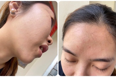 Hai nữ nhân viên y tế bị người nhà bệnh nhân túm tóc đánh