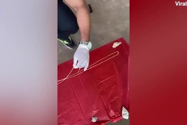 Video: Ký sinh trùng dài 18 mét tìm thấy trong người bệnh nhân