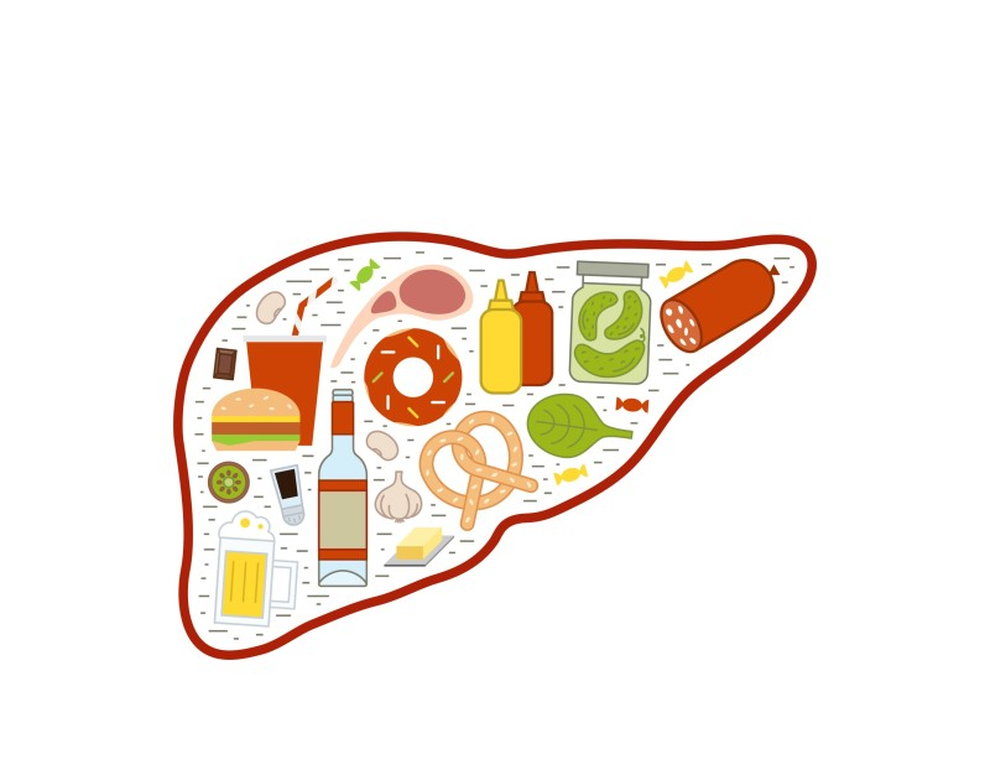 Gan nhiễm mỡ nên tránh xa những loại thực phẩm nào? - 1 Gan nhiễm mỡ nên tránh xa những loại thực phẩm nào? - 1
