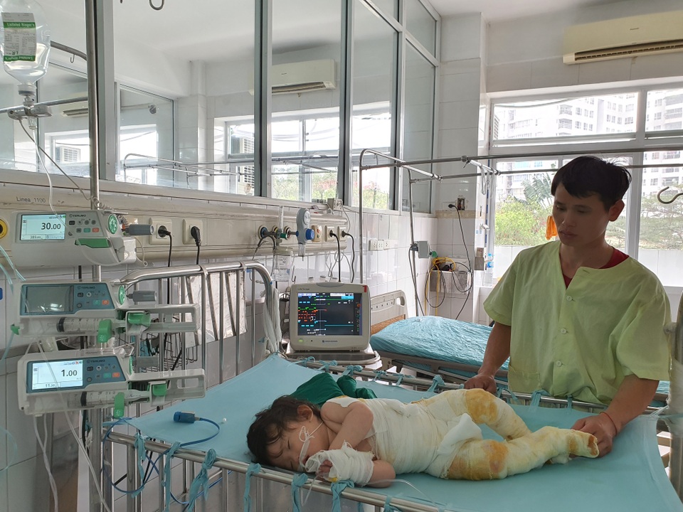 Đau nhói lòng cảnh bé gái 14 tháng tuổi ngã vào nồi nước sôi nguy kịch - 5 Đau nhói lòng cảnh bé gái 14 tháng tuổi ngã vào nồi nước sôi nguy kịch - 5