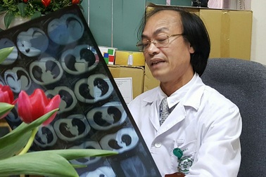 Bác sĩ chỉ cách nhận diện cơn ho cần dùng thuốc hay không khi trời nồm