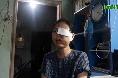 Hành trình tìm lại khuôn mặt của cô gái 15 năm ra đường phải đeo khẩu trang