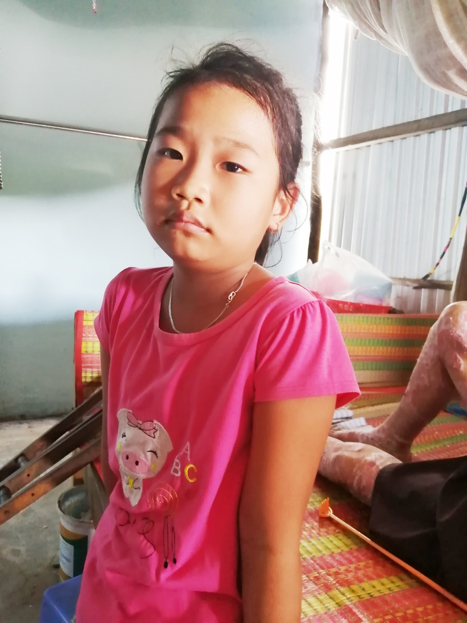Sởn da gà cảnh người đàn ông vạm vỡ bị bệnh vảy nến quật ngã có bộ da như da cá sấu - 6 Sởn da gà cảnh người đàn ông vạm vỡ bị bệnh vảy nến quật ngã có bộ da như da cá sấu - 6