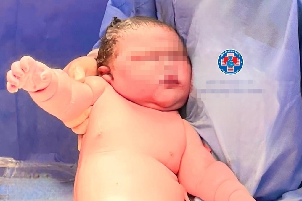 Mẹ trẻ ở TPHCM sinh con trai nặng 5,8kg, bác sĩ mỏi tay bế ra ngoài - 2 Mẹ trẻ ở TPHCM sinh con trai nặng 5,8kg, bác sĩ mỏi tay bế ra ngoài - 2
