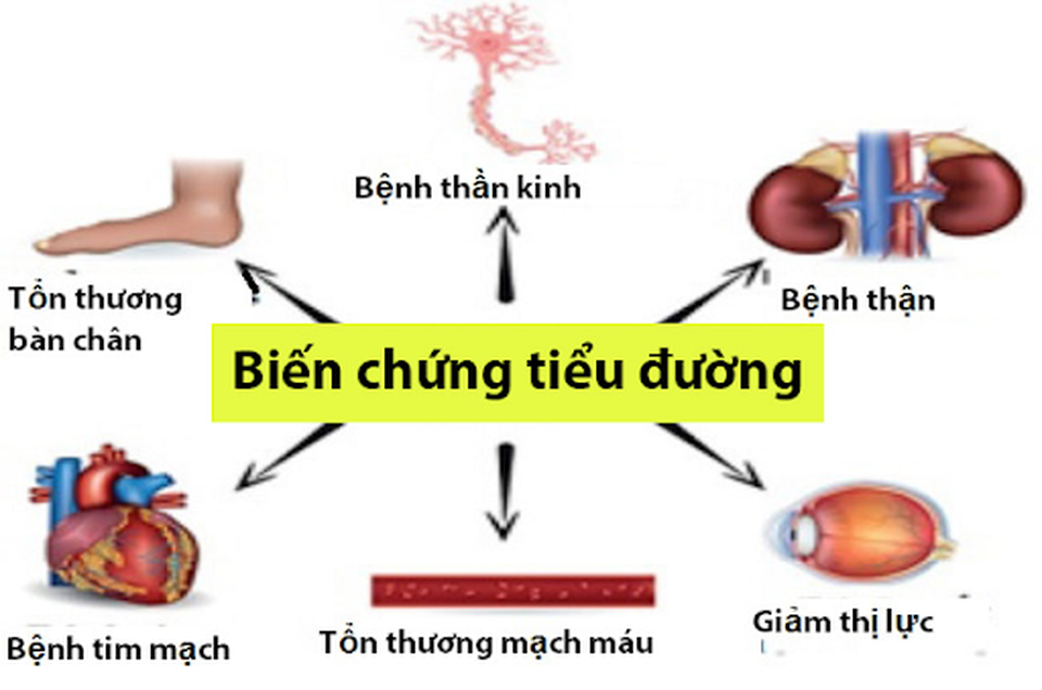 KENU TD hỗ trợ làm giảm đường huyết, giảm biến chứng ở người tiểu đường - 3 KENU TD hỗ trợ làm giảm đường huyết, giảm biến chứng ở người tiểu đường - 3