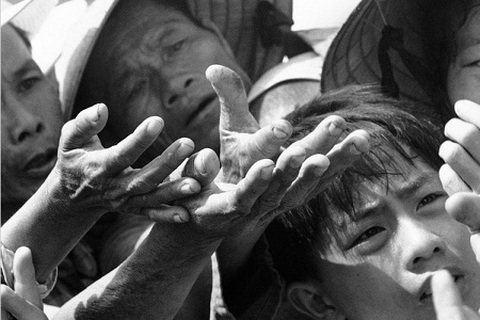 Đau thương chiến tranh qua những bàn tay