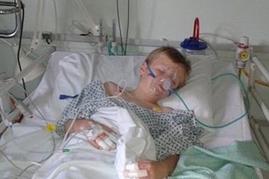 Nhiều trẻ bị bỏng khi xông hơi chữa cảm lạnh