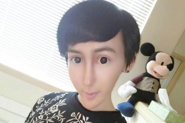 Chàng trai "mặt rắn" nổi tiếng bây giờ ra sao?