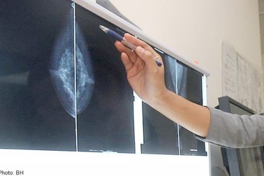 Ung thư vú: Hiểu bệnh mới điều trị hiệu quả