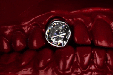 Rapper chi 1,6 triệu USD để có hai răng nanh... lấp lánh kim cương