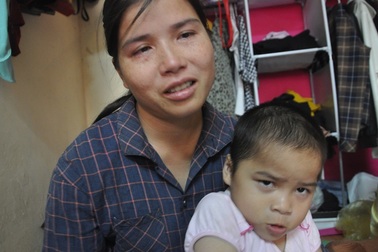 Chồng phụ bạc bỏ đi, để lại người vợ “sắp mù” phải ôm con tha phương đi bán tăm kiếm ăn