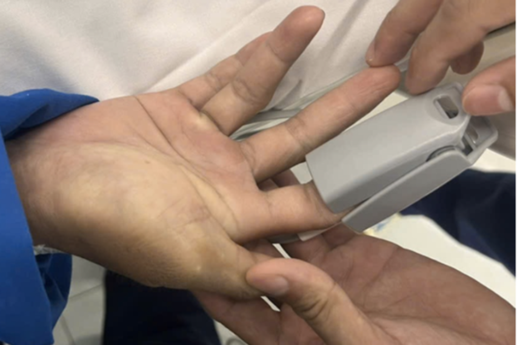 TPHCM: 5 người ngộ độc hóa chất nặng, bệnh viện khẩn cấp chia sẻ thuốc hiếm - 1 TPHCM: 5 người ngộ độc hóa chất nặng, bệnh viện khẩn cấp chia sẻ thuốc hiếm - 1