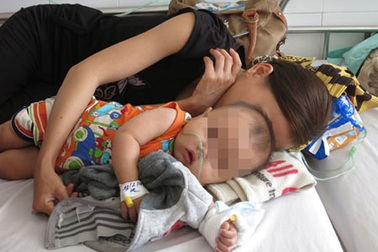 Cứu sống bé trai bệnh sởi biến chứng nặng