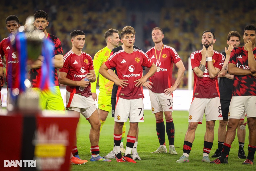 HLV Amorim: Điều tích cực là không cầu thủ Man Utd nào bị chấn thương - 1 HLV Amorim: Điều tích cực là không cầu thủ Man Utd nào bị chấn thương - 1