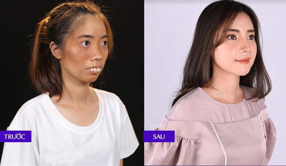 Phép thử nào cho phẫu thuật thẩm mỹ Việt? - 1 Phép thử nào cho phẫu thuật thẩm mỹ Việt? - 1