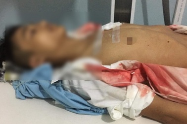 Điều tra vụ việc nam sinh lớp 11 bị đâm trước cổng trường