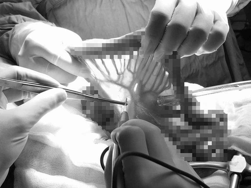 1 tháng nuốt vướng, ho đờm, người đàn ông phát hiện ung thư giai đoạn cuối - 1 1 tháng nuốt vướng, ho đờm, người đàn ông phát hiện ung thư giai đoạn cuối - 1