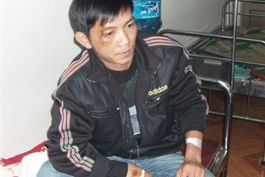 Vụ lật xe gỗ thảm khốc: Thêm một cán bộ kiểm lâm ra "trình diện"