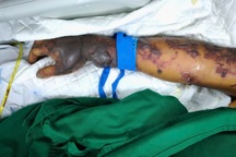 Liên tiếp ca nguy kịch, tử vong vì tiết canh: Cược mạng món ăn khoái khẩu