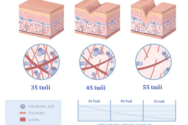 ELASTEN Việt Nam - Collagen chính thức ra mắt thị trường Việt Nam