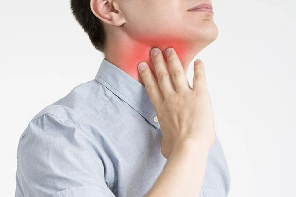 Triệu chứng ung thư vòm họng giai đoạn muộn - 1 Triệu chứng ung thư vòm họng giai đoạn muộn - 1