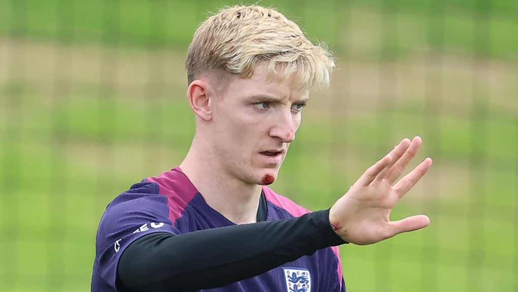 Ngôi sao đội tuyển Anh thừa nhận thoát chết vì tai nạn tại Euro 2024 - 1