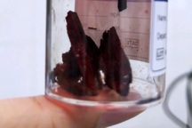 Chàng trai 19 tuổi cầu cứu 3 bệnh viện vì mảnh gỗ dài đâm xuyên hốc mắt