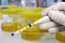 Người đàn ông nhiễm trùng máu sau khi đặt ống thông tiểu ở bệnh viện