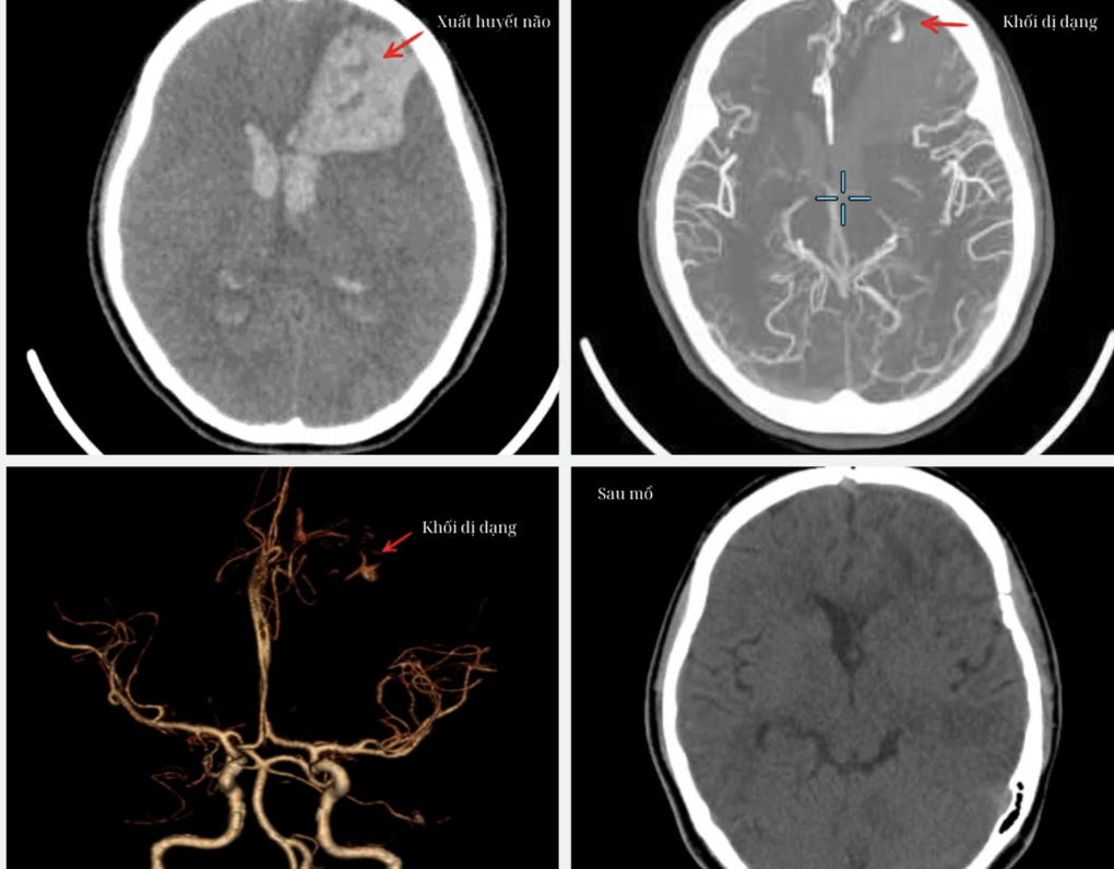 Sau tiếng động lớn, gia đình phát hiện cô gái 16 tuổi nguy kịch ở phòng tắm - 1
