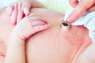 Cắt dây rốn trẻ sơ sinh bằng dao lam: 2 bé tử vong, 1 nguy kịch