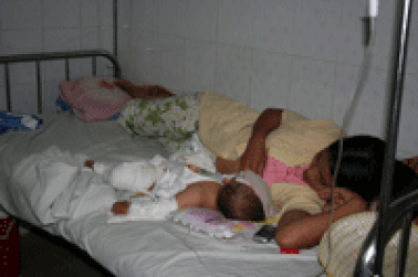 Tai nạn bỏng “nóng” ngay từ đầu hè