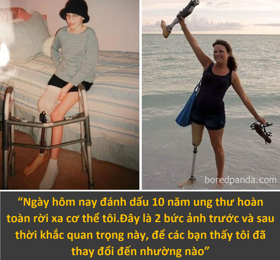 Màn lột xác ngoạn mục của những con người chiến thắng ung thư - 4 Màn lột xác ngoạn mục của những con người chiến thắng ung thư - 4