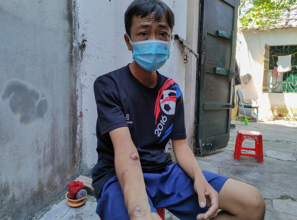 Xóm chạy thận bên đường tàu co ro bởi giặc Covid-19 - 2 Xóm chạy thận bên đường tàu co ro bởi giặc Covid-19 - 2