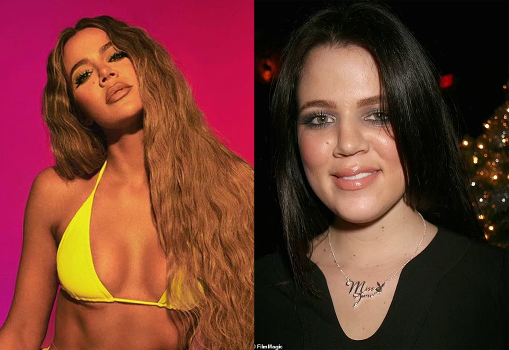 Ngoại hình khác lạ, Khlóe Kardashian phủ nhận tin đồn sửa mặt 12 lần - 2 Ngoại hình khác lạ, Khlóe Kardashian phủ nhận tin đồn sửa mặt 12 lần - 2