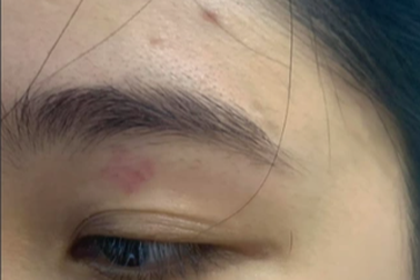 Nhân viên quán bánh mì Nguyên Sinh đánh khách: Chuyển hồ sơ công an quận