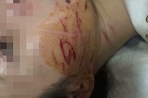 Vụ cô gái bị lột đồ, đổ nước mắm lên người: Triệu tập 2 đối tượng