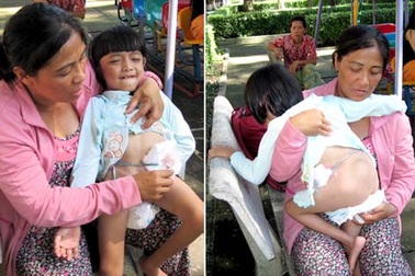Nỗi gian truân của mẹ con cô bé không có bộ phận sinh dục