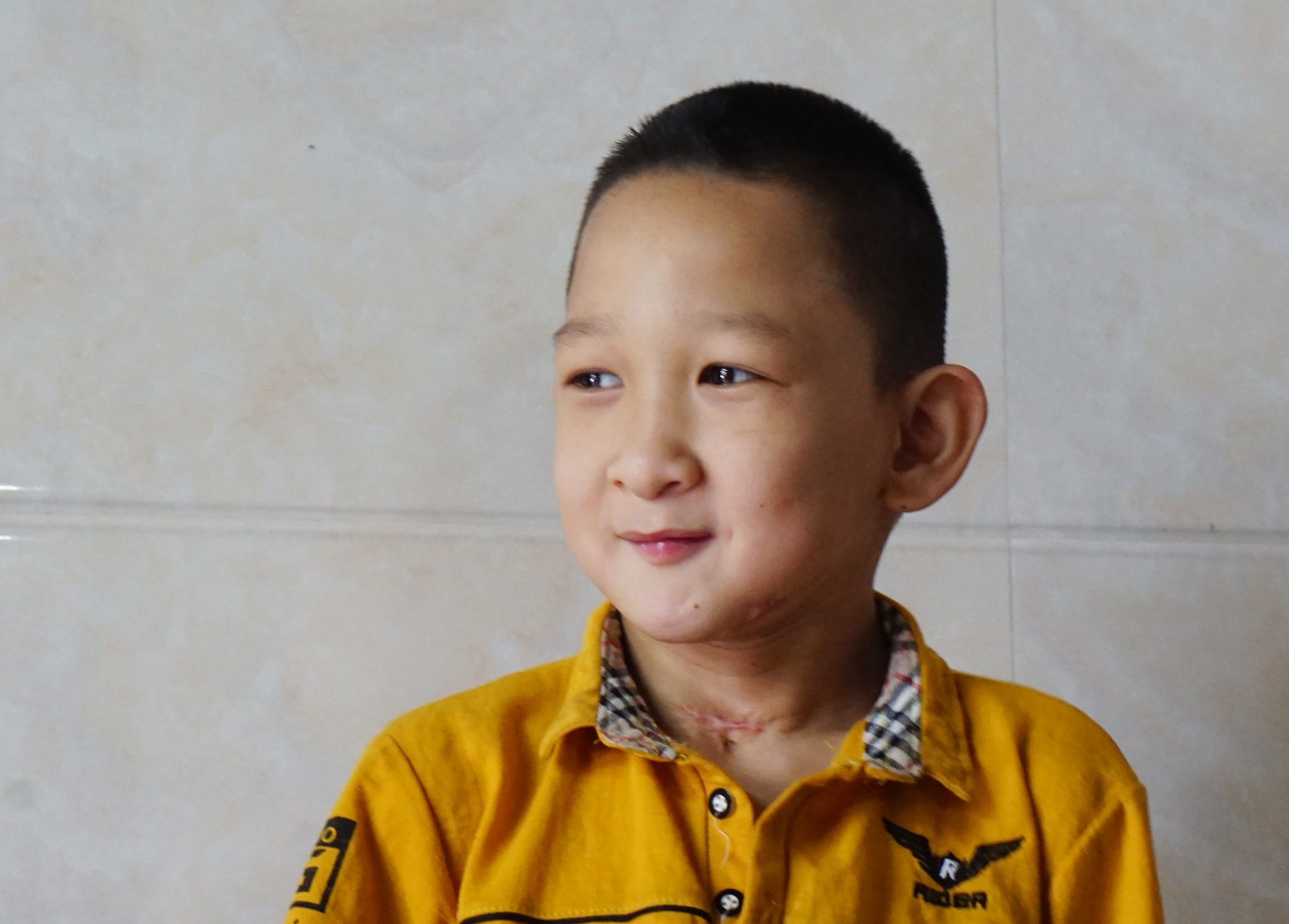Hành trình hồi sinh đầy gian nan của cậu bé đa dị tật 2 lần bị bỏ rơi - 1 Hành trình hồi sinh đầy gian nan của cậu bé đa dị tật 2 lần bị bỏ rơi - 1