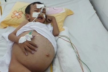 Bài 1: Những thân bệnh lay lắt chờ nguồn tạng hiến