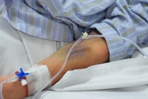 Ngỡ chỉ là cơn sốt nhẹ, người đàn ông rơi vào sốc sốt xuất huyết nguy kịch