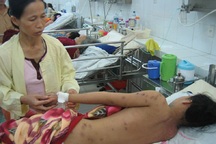 Cứu sống một học sinh bị ong vò vẽ đốt hơn 100 mũi