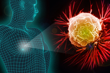 Nam giới có đặc điểm này cần cảnh giác với bệnh ung thư vú