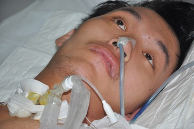 Bị viêm não Nhật Bản, tính mạng chàng tân sĩ quan dân tộc Mường nguy kịch