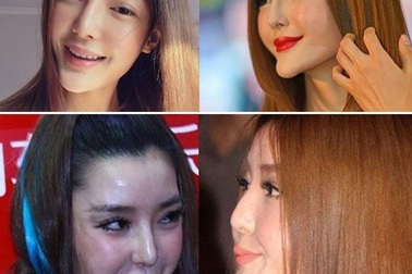 Những chiếc cằm “biến dạng” của người đẹp Hoa ngữ