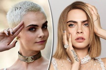 Vì sao Cara Delevingne trượt ngã trên khối tài sản "khủng"?